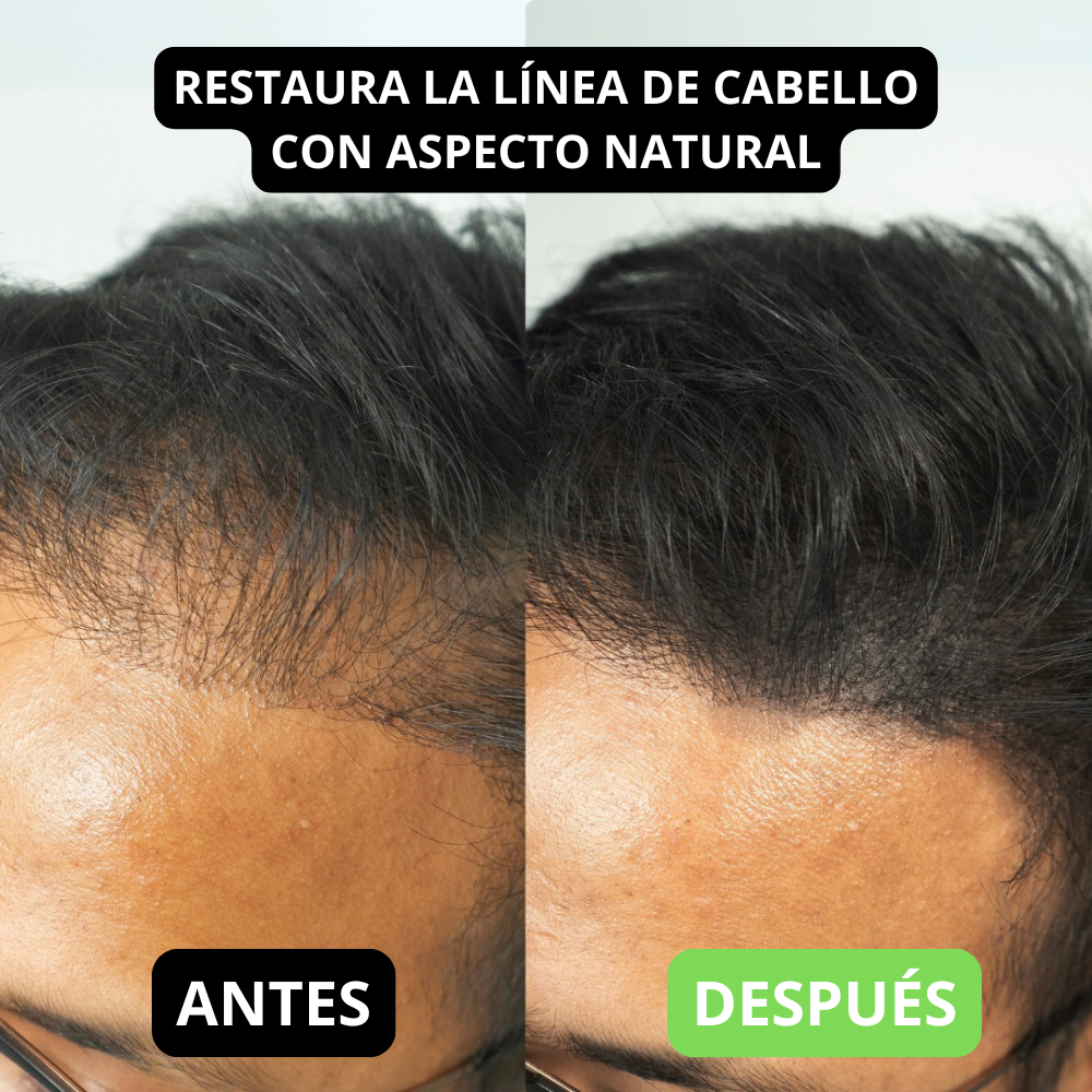 Polvo para Cabello - Sevich