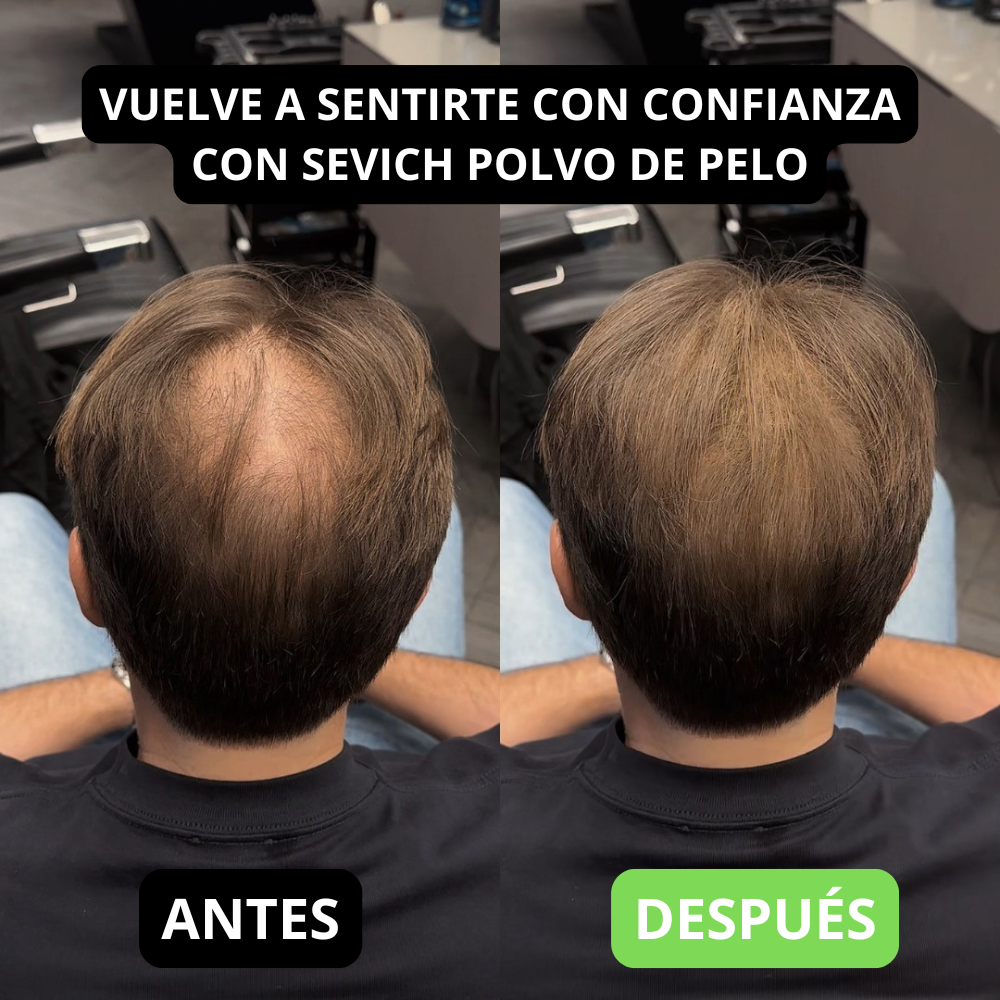 Polvo para Cabello - Sevich