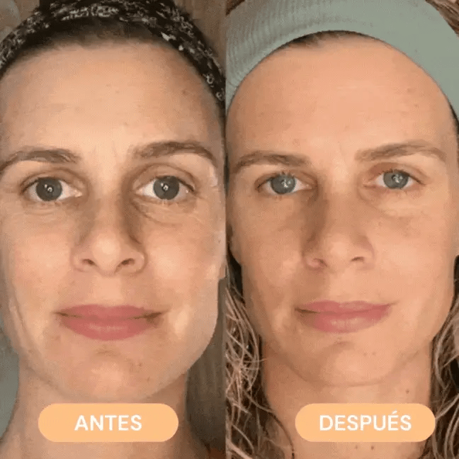 Masajeador Facial ANTIARRUGAS + Mascarilla GRATIS